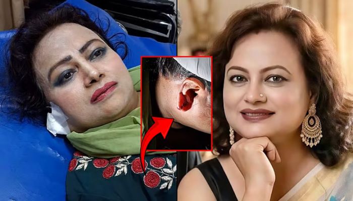 নায়িকার কান ছিঁড়ে নিলো ছিনতাইকারী, লেগেছে ৭ সেলাই
